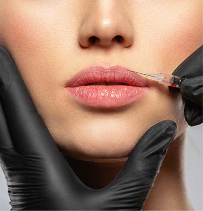 Lip Fillers